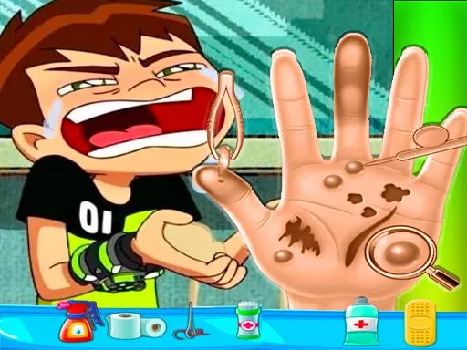 Ben10 Hand Doctor - Free Online Game - game thumbnail image