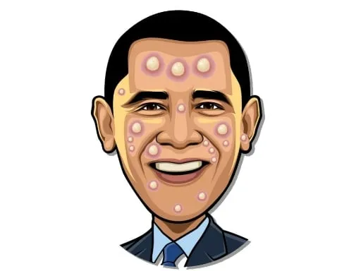 Celebrity Pimple Pop - game thumbnail image